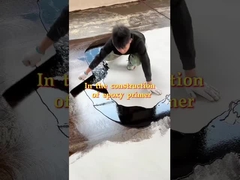 병원 들 이 에포시 를 선택 하는 이유